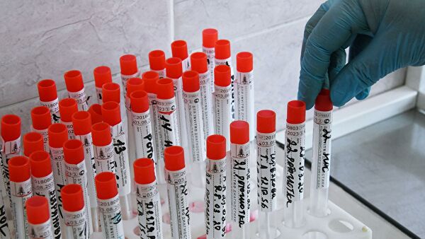 ВОЗ отправит положительные образцы в Англию для анализа коронавирусов, циркулирующих в Кыргызстане