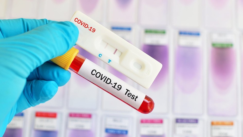 В Кыргызстане зарегистрировали еще 28 случаев коронавируса. Всего — 871