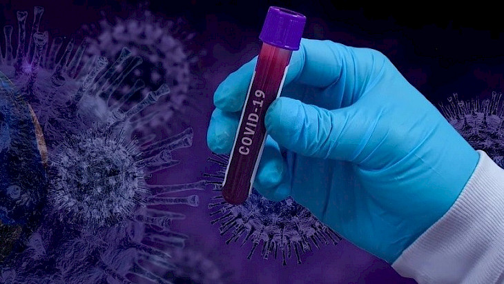 COVID-19 коронавирустук инфекциясы: Баардык адамзаттын кырсыгы жана саясий оюндардын куралы